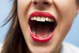 woman s burning mouth syndrome had