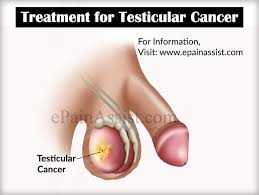 Warning signs of testicular cancer. Testicular Cancer Causes Symptoms Treatment Survival Rate