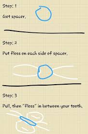 Of course, you'll need to thread the floss back out instead of moving the floss back up in between your teeth. How To Put A Spacer Back In Spacer Floss Chart