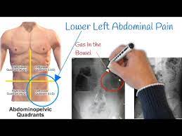 pain in lower left abdomen low