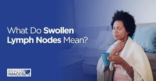 what do swollen lymph nodes mean