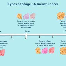 The organs in the female reproductive system include the uterus, ovaries. Stage 3 Breast Cancer Types Treatment Survival