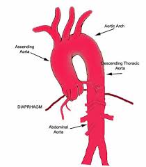 3 Scheme Of The Aorta From My Clevelandclinic Org