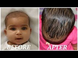 If your baby has scanty or little hair on their scalps, read the information to find ways to increase the hair growth of your child. How To Grow Your Babies Hair Back Fast Youtube Grow Baby Hair Baby Hair Growth Baby Hairstyles