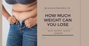 gastric sleeve surgery weight loss you