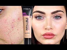 colour correct acne scars collab