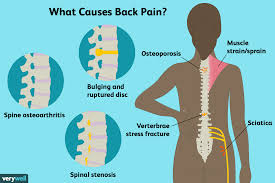back pain causes treatment and when