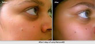 nerium ad age defying treatment review