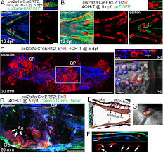 Related posts of long bone labeled. Programmed Conversion Of Hypertrophic Chondrocytes Into Osteoblasts And Marrow Adipocytes Within Zebrafish Bones Elife