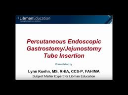 percutaneous endoscopic gastrostomy