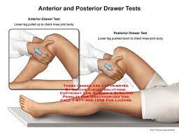 knee special tests flashcards quizlet