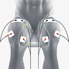 Quads Electrode Pad Placement Ems Tens Electrodes