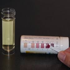 Urine Testing Stix Canine Diabetes Wiki Fandom