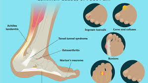 Foot and ankle ligament and tendon reconstruction is surgery that repairs damaged ligaments or tendons in the lower extremity. Foot Pain Causes Treatment And When To See A Doctor