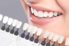 Teeth Whitening Rivervale Burswood Lathlain Wa Dentists