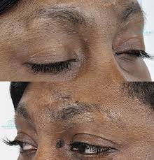 fundamentals of permanent makeup course