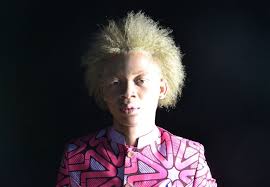 Résultat de recherche d'images pour "albinos"