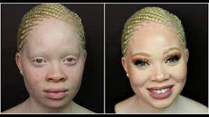 albino skin makeup obsession