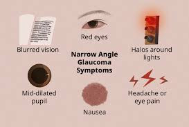 narrow angle glaucoma symptoms and causes