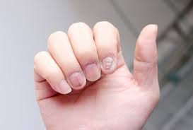 9 tips to prevent a nail infection