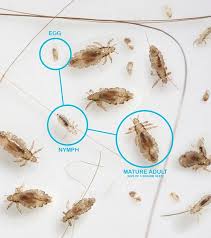 Head Lice Pictures What Do Head Lice Louse Nits And Eggs