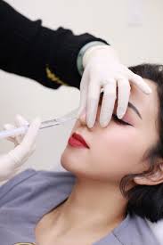 nose reshaping 67 degrees cosmetic clinic