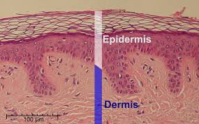 Learn about the skin's function and conditions the skin protects us from microbes and the elements, helps regulate body temperature, and permits the sensations of touch, heat, and cold. Epidermis Wikipedia