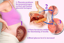 Case Study Diabetes Pregnancy SlideShare