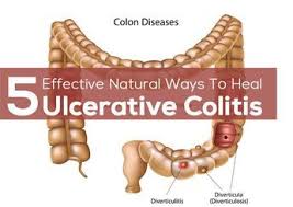 Ulcerative Colitis Diet Foods To Eat And Avoid With Diet