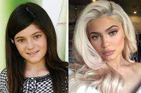 See the reality tv star dance with her bff. Kylie Jenner Plastic Surgery Before And After Who Magazine
