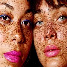 skincare tips for people with freckles