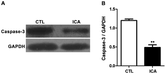 Inhibitory Effect Of Icariin On Osteosarcoma Cell