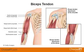 physical therapy guide to biceps tendon
