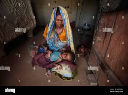 20 Monate alte Rinku, wiegt 4 kg und leidet an schwerer Unterernährung,  liegt in seiner Mutter Schoß im Naingarh Dorf Sheopur Distrikt im indischen  Bundesstaat Madhya Pradesh 6. April 2010. Indien auf