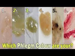 118 What Does The Color Of My Phlegm Means Yellow Brown