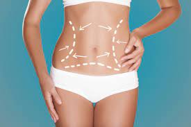 What is Meant By Tummy Tuck, and How Does it Work?