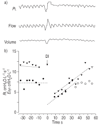 A Strip Chart Of Simultaneous Measurements Of