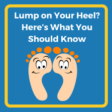 I have a knot about the size of a golf ball a few inches above my heel. Have A Bump On Your Heel Here S What You Should Know Heel That Pain