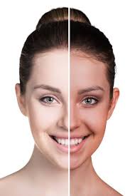 Read our tips for fixing uneven try to use cooling face masks to help further soothe uneven skin on the face and reduce blemishes. Best Creams For Uneven Skin Tone In India Makeupandbeauty Com