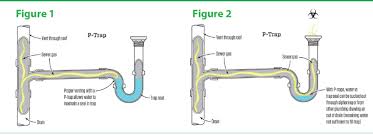 green drain 3 5 drain net liquid