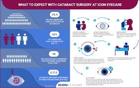 what to expect with cataract surgery