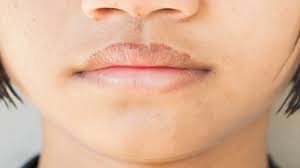 7 home remes for chapped lips health