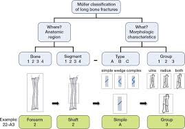 The Müller Classification Of Long Bone Fractures Download