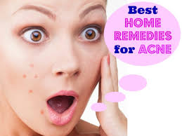 top 10 home remes to treat acne