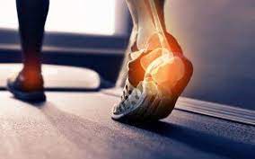 causes of heel pain from running
