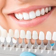 Teeth Whitening Cosmetic Dentist Estrada Dentistry