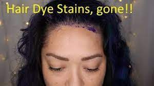 remove hair dye stains from your skin