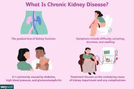 Chronic Kidney Disease Symptoms Diagnosis And Treatment
