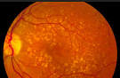 retinal scan