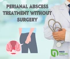 peri abscess treatment without surgery